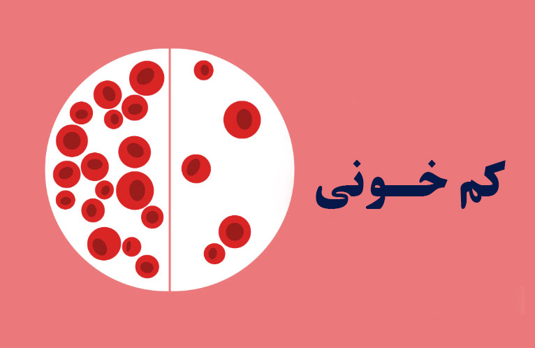 کم خونی ناشی از فقر آهن، چه عوارضی دارد