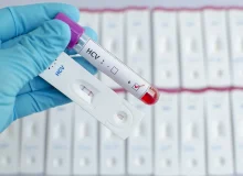 بیش از ۱۰ هزار تست تشخیص سریع هپاتیت در فارس انجام شد